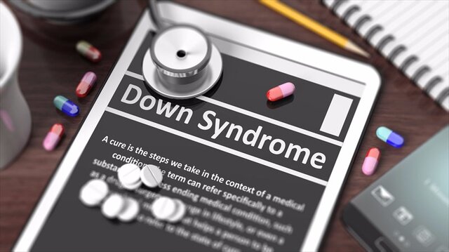 تشخیص تاخیرهای شناختی در بیماری سندروم داون