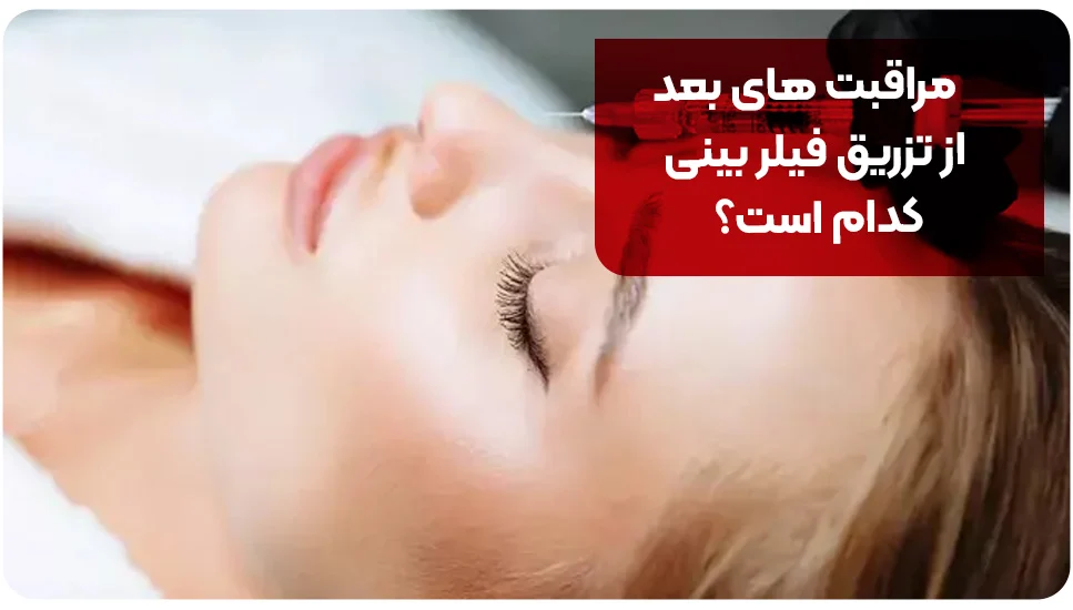 مراقبتهای بعد از تزریق فیلر بینی کدام است؟