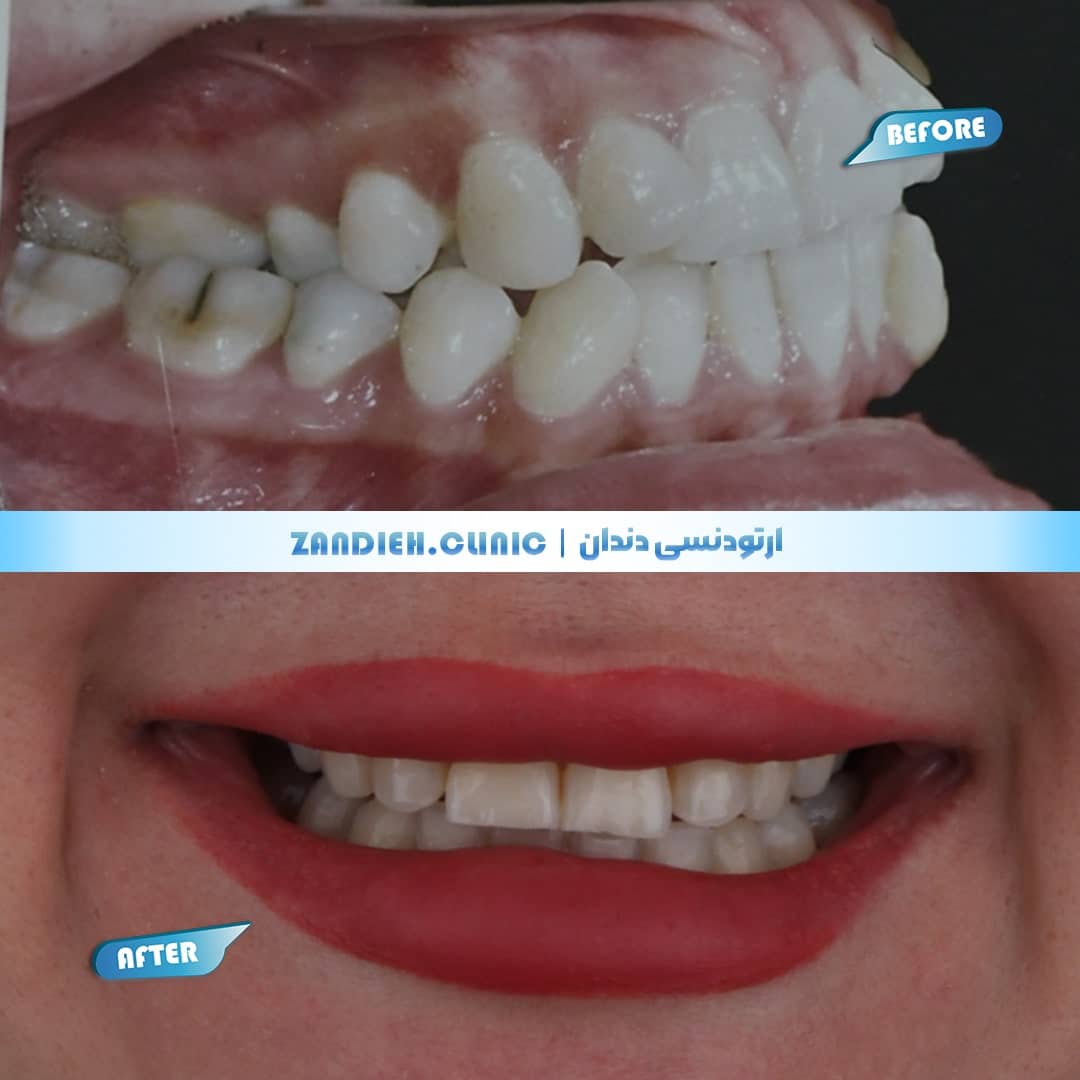 ارتودنسی کلینیک زندیه
