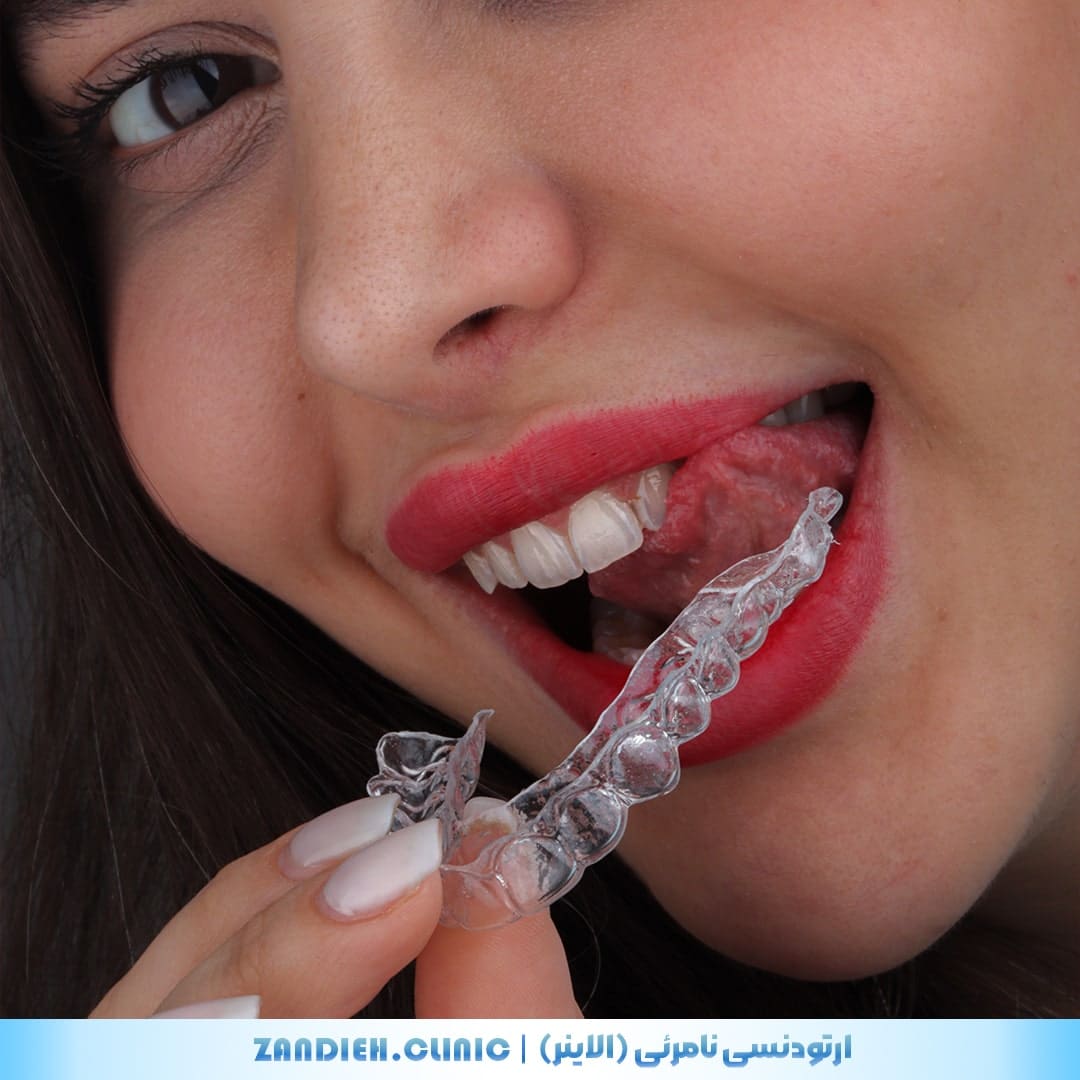 ارتودنسی کلینیک زندیه در شیراز