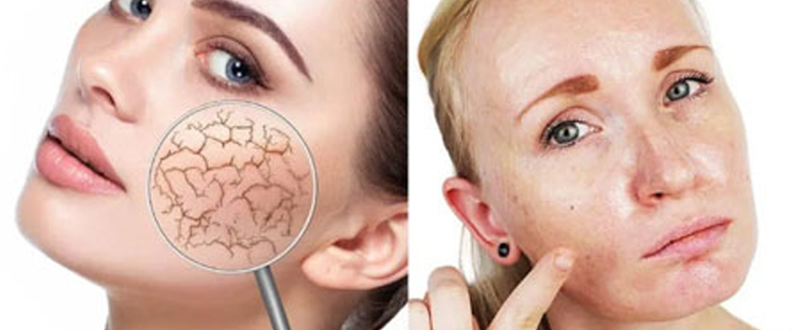 نکات تکمیلی برای اثربخشی محصولات سیلکر