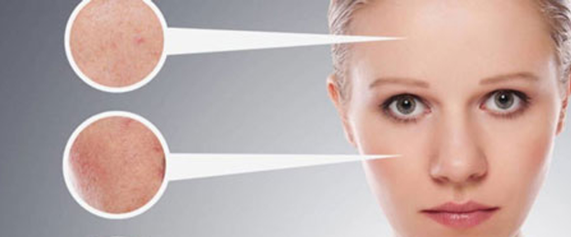 پوست مختلط و روش مراقبت ترکیبی