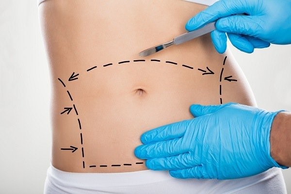 جراحی چاقی چیست و جراح چاقی کیست؟