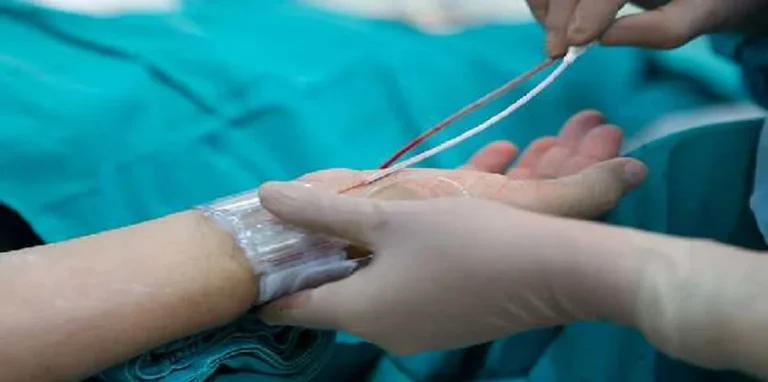 مراقبت بعد از آنژیوگرافی قلب چیست