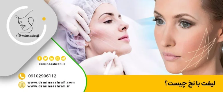مروری بر ویژگی های بهترین دکتر لیفت با نخ در تهران
