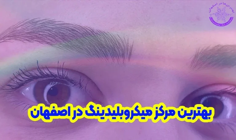 میکرو و فیبروز بعد از چند روز طبیعی می شود؟