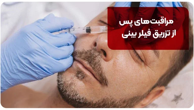 مراقبت های پس از تزریق فیلر بینی